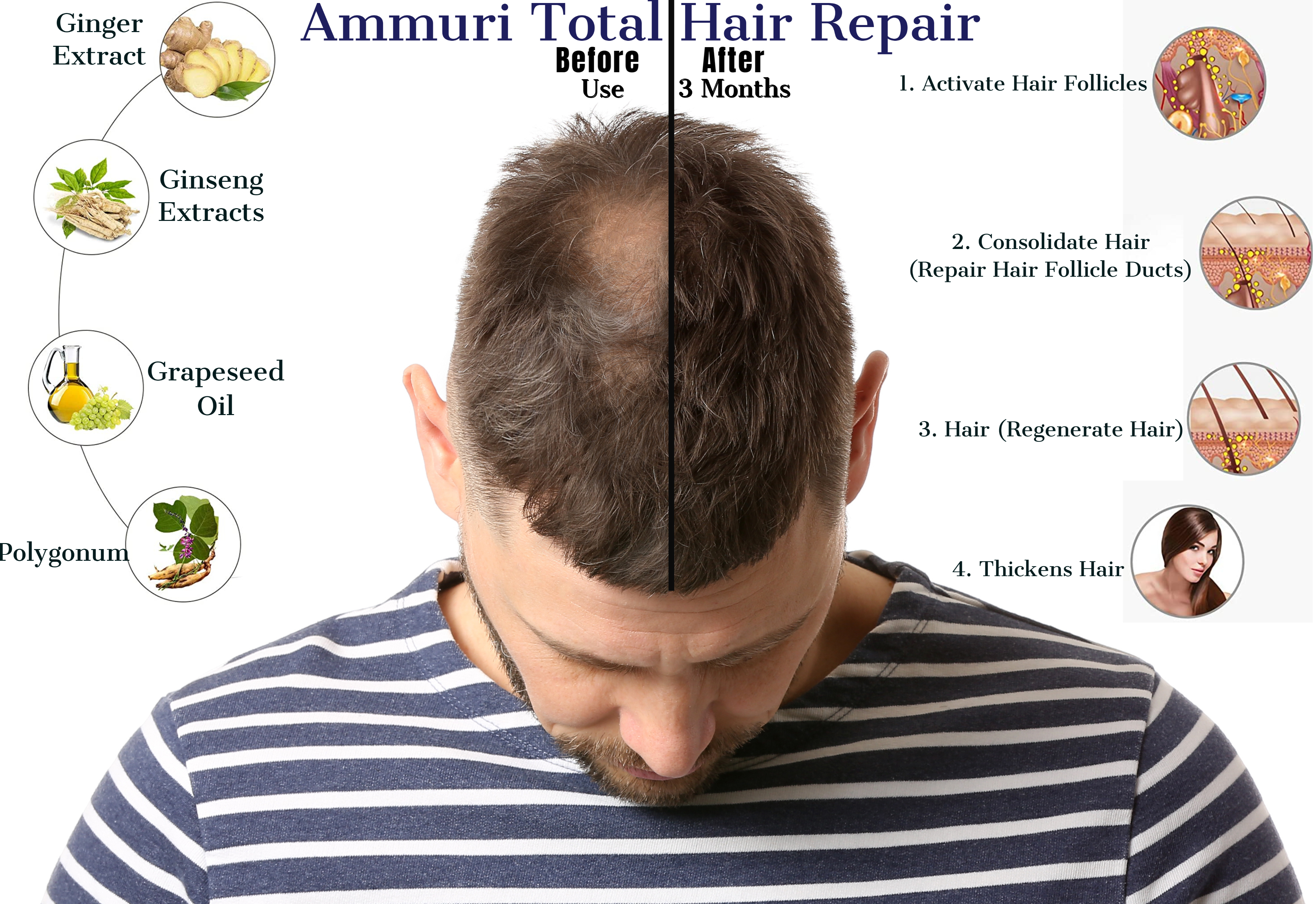 Ammuri Anti Hair Repair Growth Serum Hair Thinning Balding Repair Hair Follicles for Men and Women